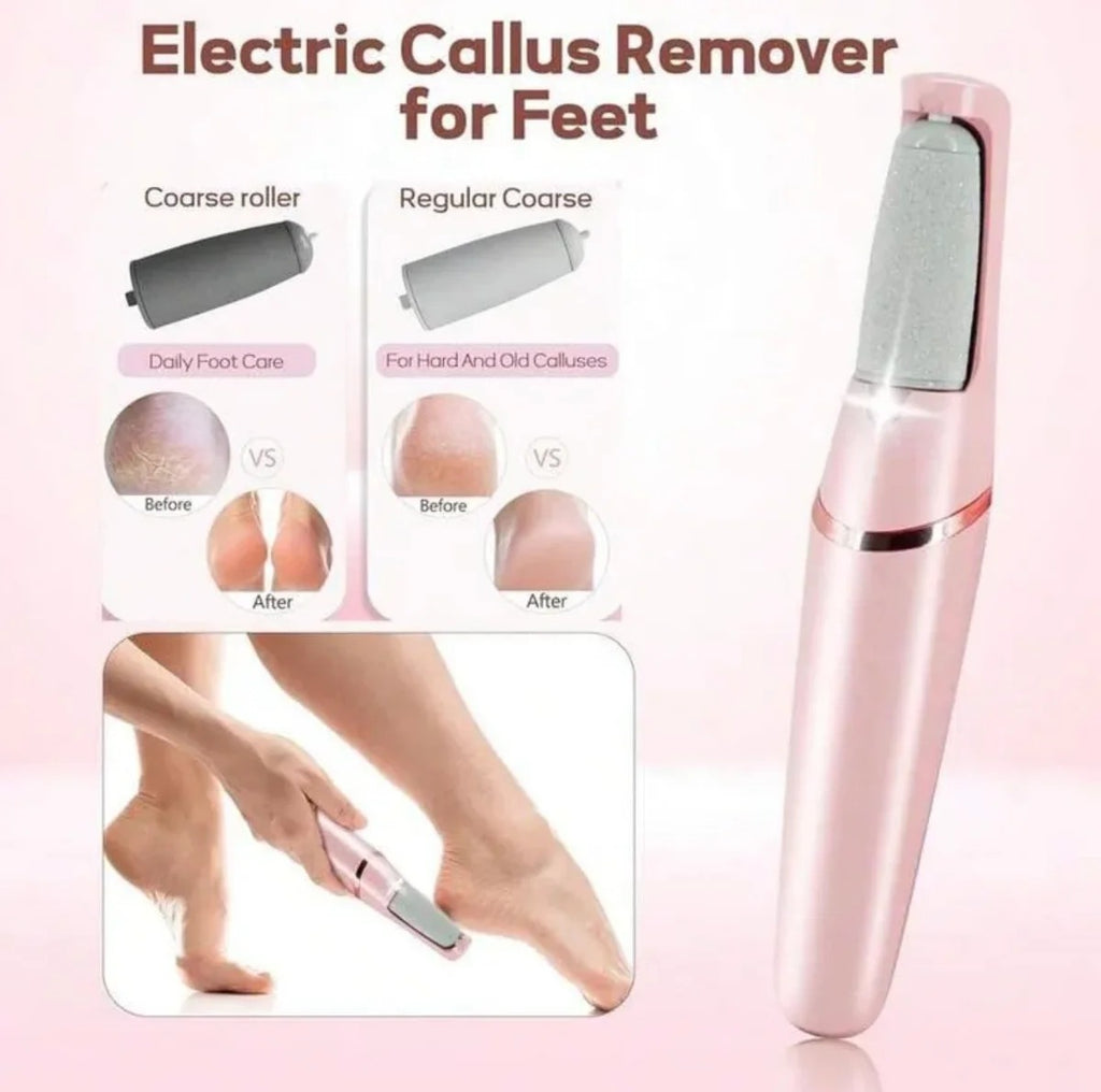 Callus Remover for Smooth Feet