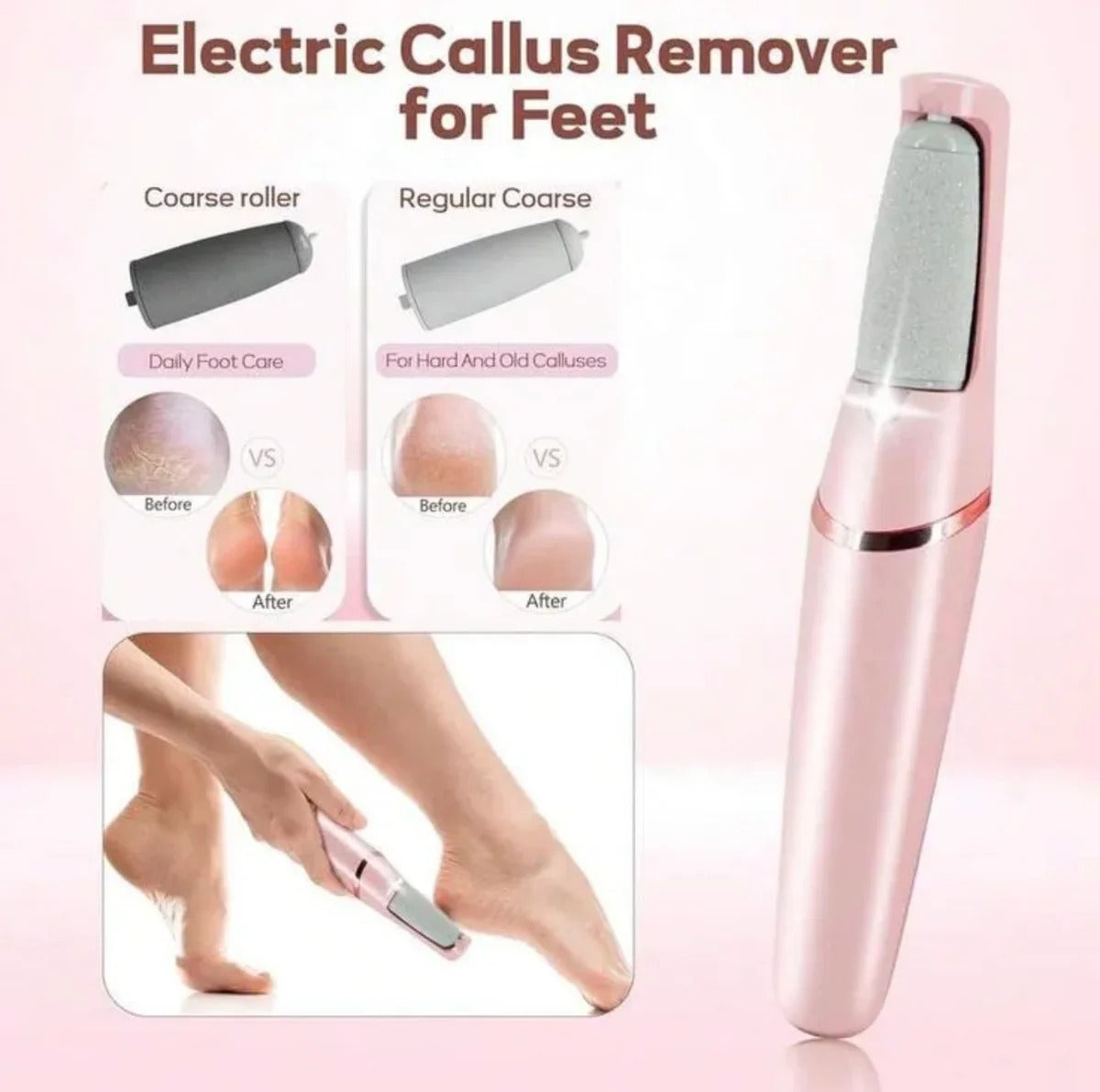Callus Remover for Smooth Feet